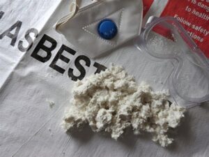Asbestosis
